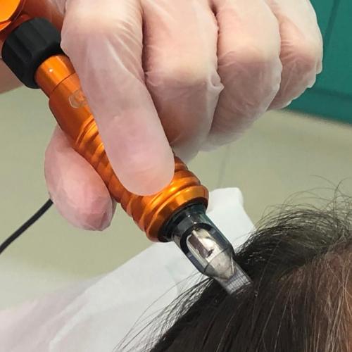 Tratamento para crescimento capilar no Paraná