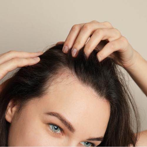 Tratamento para queda de cabelo feminino